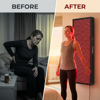 Red Light Therapy Panel Device – Full Body Panel, 630Nm 660Nm 810Nm 850Nm Red & near Infrared Light Therapy, 300 Quad Chip Leds, Brightness Control, Pulse Mode – ULTRA1500 — Before & After